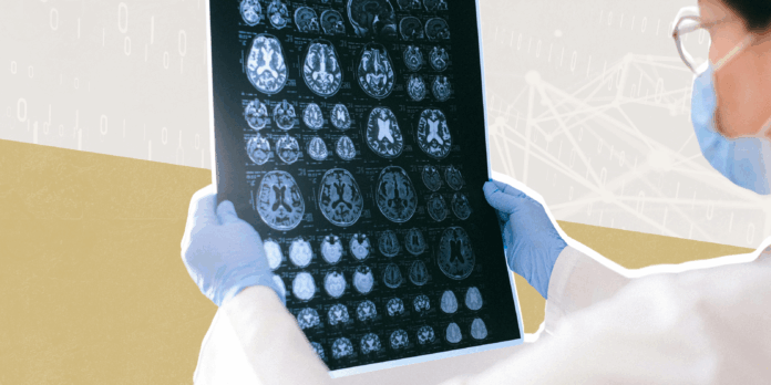 Free AI Tools Can Help Doctors Read Medical Scans—Safely and Affordably
