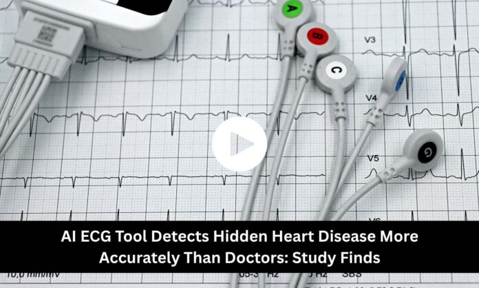 AI ECG Tool Detects Hidden Heart Disease More Accurately Than Doctors: Study Finds