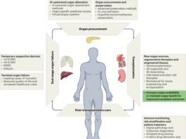 Reshaping transplantation with AI, emerging technologies and xenotransplantation