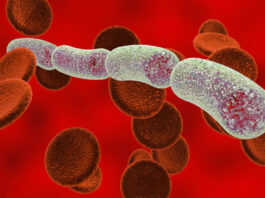 What this Ohio health system learned from testing an AI tool to predict sepsis