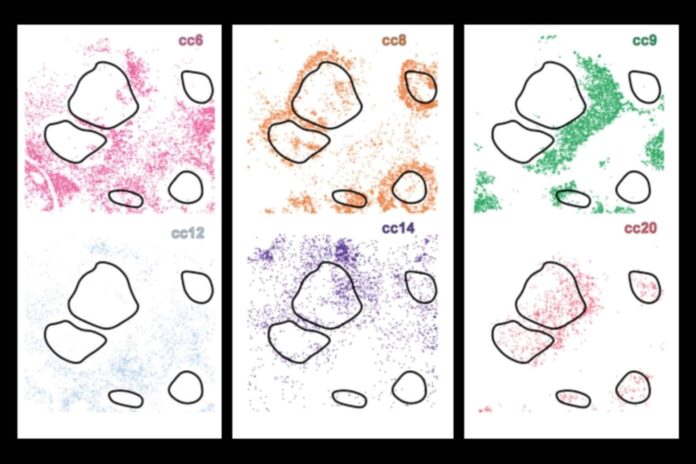 CellLENS.jpg AI tool maps cancer in 3D detail
