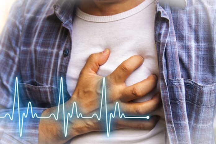 cardiac-arrest.jpg Brighter Side of News