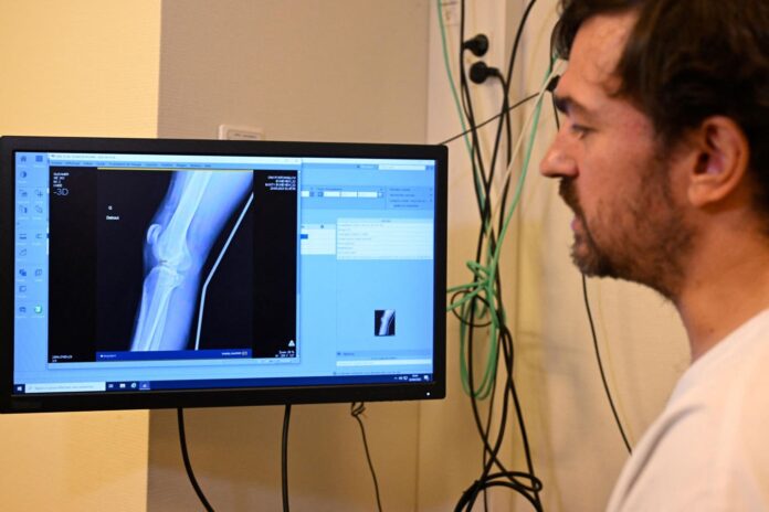 AI Tools May Degrade Doctors’ Skills
