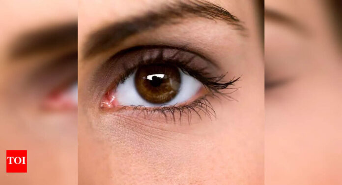 1756588244_photo.jpg Doctors validate AI tool for glaucoma detection using smartphone cameras | Hyderabad News