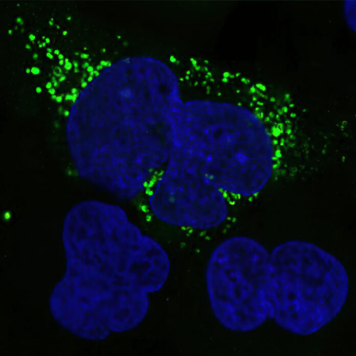 New AI tool illuminates “dark side” of the human genome