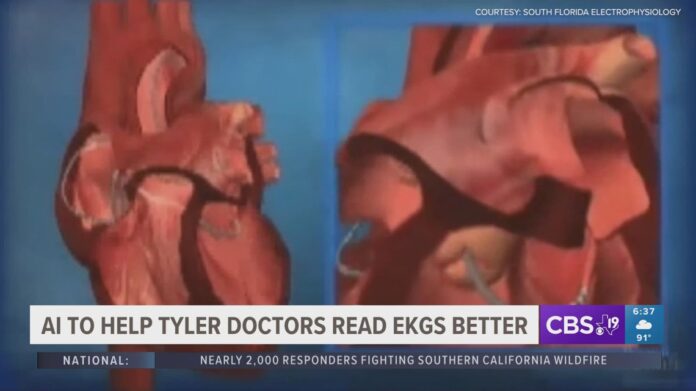 6ebc512b-1ac3-46b9-a72a-3ccdbf5e615a_1140x641.jpg UT Tyler receives $174,000 grant to help A.I. able to understand EKG readings