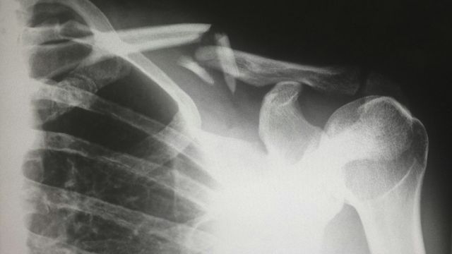 ai-tool-reduces-the-need-for-large-datasets-in-medical-image-segmentation-403034-640x360.jpg AI Tool Enhances Medical Image Segmentation