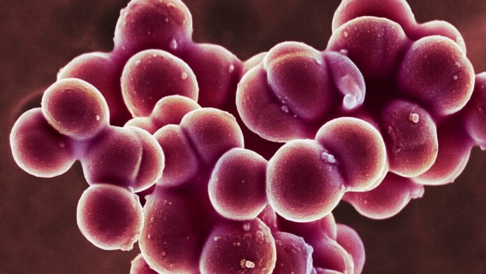 gettyimages-1201440496.jpg Staphylococcus aureus (MRSA) coccoid bacteria, colored scanning electron micrograph (SEM)