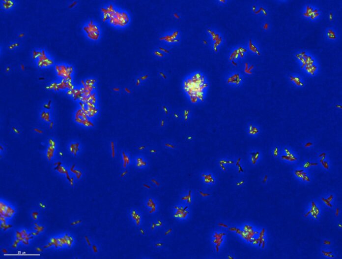tb_image_bree_aldridge_study.jpg New AI Tool Reveals How Drugs Kill Tuberculosis