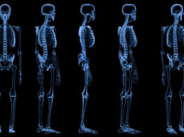 AI is helping my doctors treat my cancer