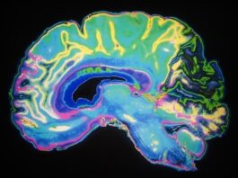 AI tool SeeMe detects hidden signs of consciousness in brain injury patients