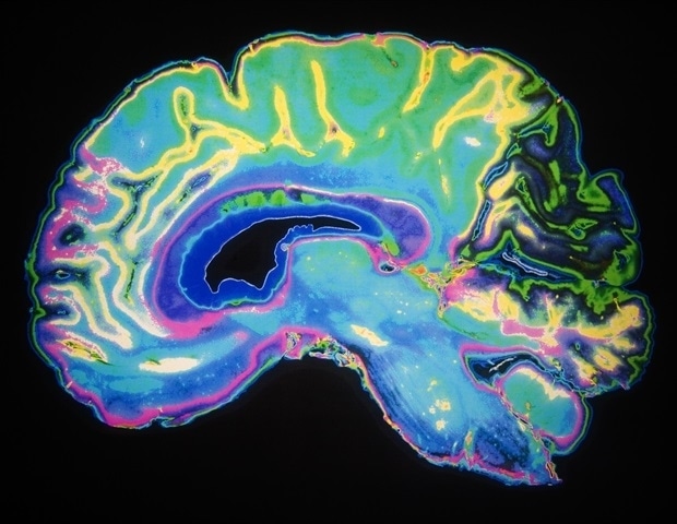 Artificially_Colored_MRI_Scan_Of_Human_Brain-Daisy_Daisy_a8c5d8bbbf824bc8932308e30187510f-620x480.jp_.jpeg AI tool SeeMe detects hidden signs of consciousness in brain injury patients
