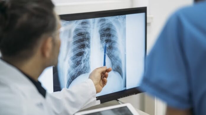 Two-radiologists-examine-a-medical-image-of-a-chest.jpg.jpeg Radiologists’ eye movements help Welsh team build smarter medical AI tools