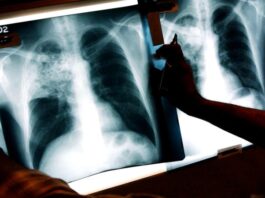 Expert: this new AI tool can forecast your risk for 1000 diseases