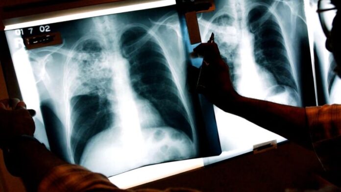 Expert: this new AI tool can forecast your risk for 1000 diseases