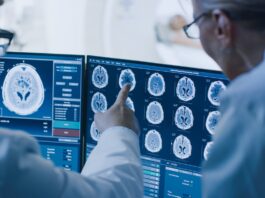 ‘Revolutionary’ AI-assisted tool could help stroke patients make full recovery
