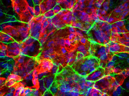 How AI is transforming retinal imaging