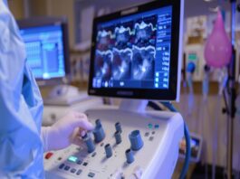 echocardiogram
