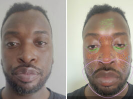I Let AI Diagnose My Skin—Here's What it Got Right and Wrong
