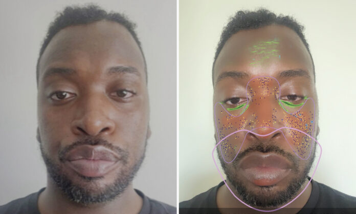 I Let AI Diagnose My Skin—Here's What it Got Right and Wrong