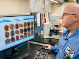 AI excels at detecting parasites in stool samples, study finds – @theU