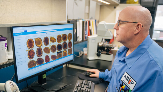 Blaine-Mathison_feature.jpg AI excels at detecting parasites in stool samples, study finds – @theU