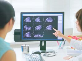 The AI model that could predict illness decades before symptoms appear - The Independent