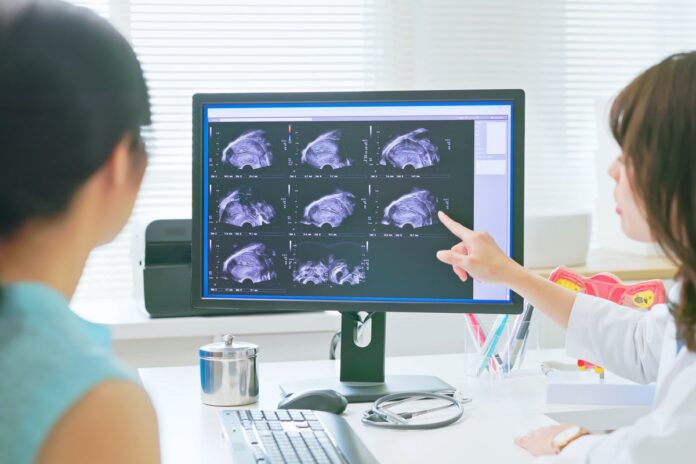 The AI model that could predict illness decades before symptoms appear - The Independent