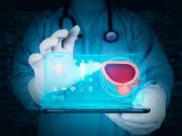NHS launches AI tool to speed up prostate cancer diagnosis