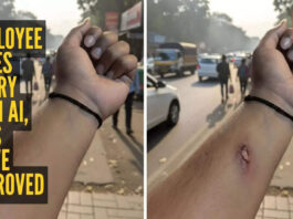 Employee fakes a hand injury using THIS AI tool, and HR approves his leave instantly