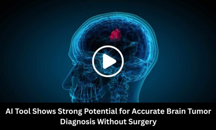 AI Tool Shows Strong Potential for Accurate Brain Tumor Diagnosis Without Surgery: Study