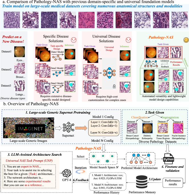 41746_2025_2042_Fig1_HTML.png Large language models driven neural architecture search for universal and lightweight disease diagnosis on histopathology slide images