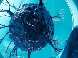 Innovation. An AI prostate tool that analyzes biopsy images to predict metastasis and mortality risks – Medical Buyer