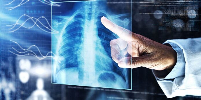 New AI Tool Decodes DNA To Predict Mutation-Induced Diseases - Outlook India