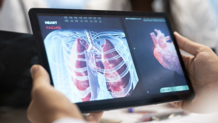 A new AI model is being used to help diagnose tuberculosis, one of the world's deadliest diseases.