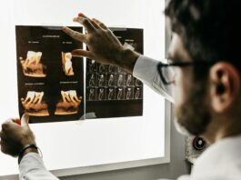 AI Tool Promises Accurate Brain Tumor Diagnosis Sans Surgery
