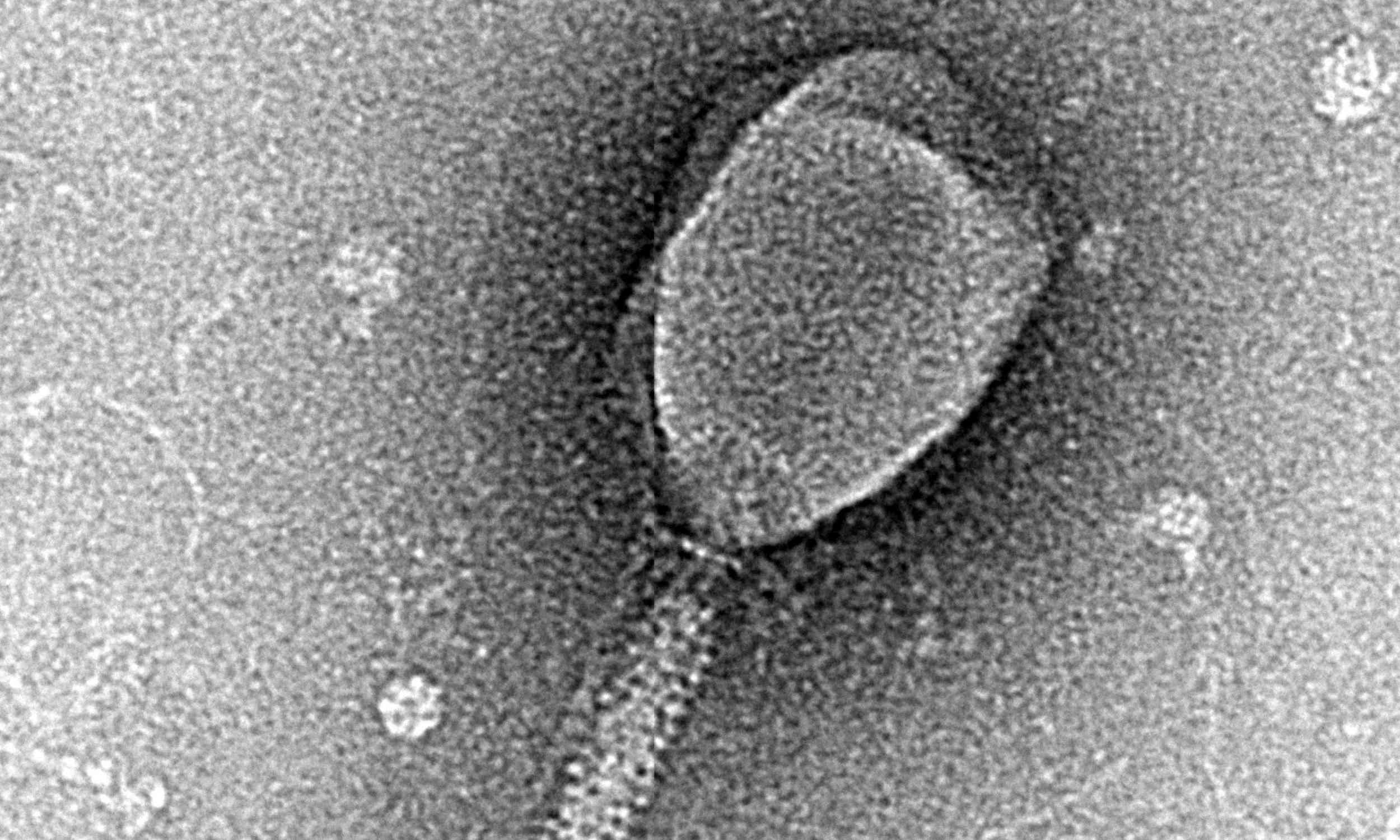 ai-create-viruses-from-scratch-biosecurity-risk.jpg AI can now design viruses, raising new biosecurity risks