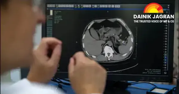 China Deploys AI Tool to Detect Early-Stage Pancreatic Cancer, Raising Hopes Against One of the Deadliest Diseases