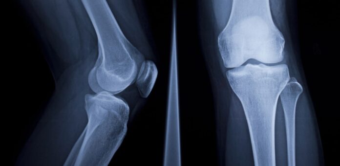 Practical Applications of AI in MSK Radiology