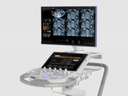 GE HealthCare expands fetal ultrasound AI tools through Diagnoly collaboration