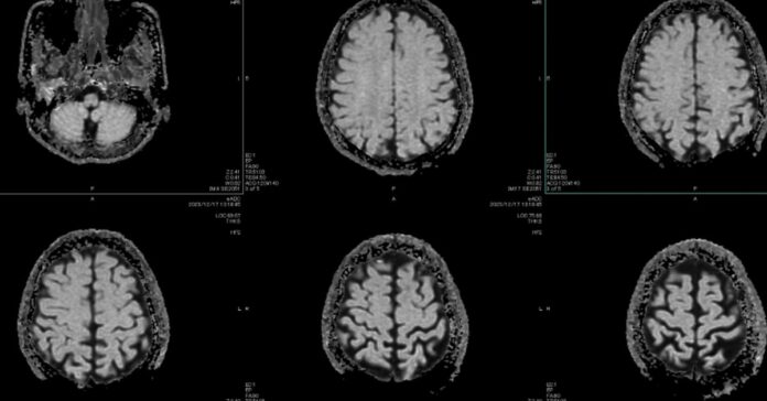 Healthcare Is AI’s Hardest Test
