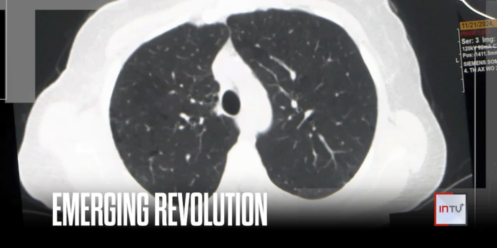 How AI could help doctors find lung cancer earlier — and save more lives