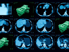 AI could check millions of lung cancer scans for heart risk. Who will pay for it?